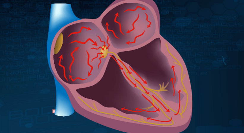 Langzeit-EKG (Holter-EKG, 24h-EKG) - Prof.Dr. Jolanta Siller-Matula, PhD - Internistin Klosterneuburg 3400