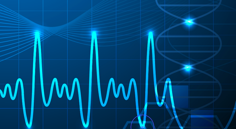 Elektrokardiogram (EKG) - Prof.Dr. Jolanta Siller-Matula, PhD - Internistin Klosterneuburg 3400