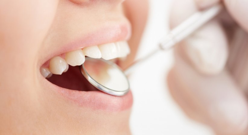 Professionelle Mundhygiene / Zahnprophylaxe - Dr.med.dent. Natascha Witzmann - Zahnärztin Wien 1020