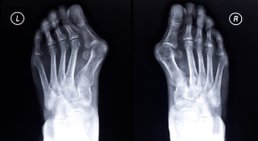 Univ.Prof. Dr. Hans-Jörg Trnka - Orthopäde Wien 1080