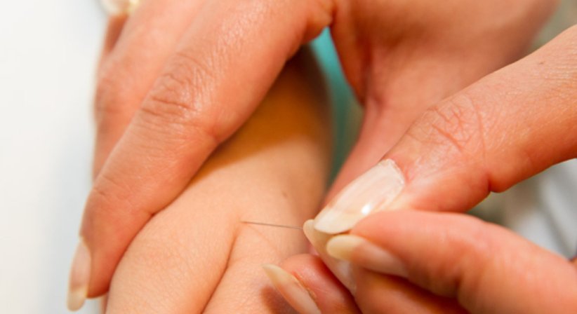 Akupunktur - Dr. Azita Schlarp-Ahmadzadeh - Praktische Ärztin Korneuburg 2100