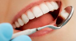 Prophylaxe -