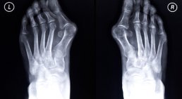 Dr. Rudolf Kramer - Orthopäde Wien 1210