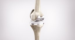 Knieprothese -
