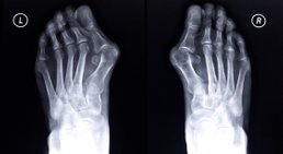Prim. Assoz. Prof. Dr. Bernd Kubista, MSc - Orthopäde 1090 Wien