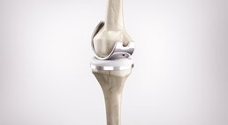 Dr. Robert Legenstein, MSc - Orthopäde Klosterneuburg 3400