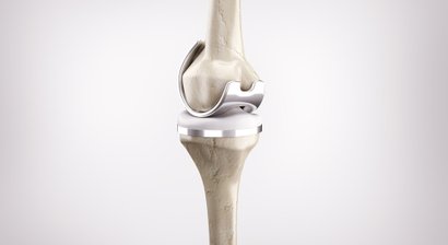 Knieprothese
