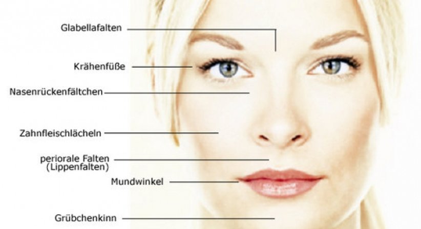 Botox-Behandlungen gegen Falten und Migräne - Univ.-Prof. Dr. Mathias Zirm - Augenarzt Wien 1010