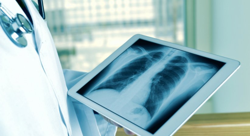 Röntgen - Doz. Dr. Michael Gruber - Radiologe Baden 2500