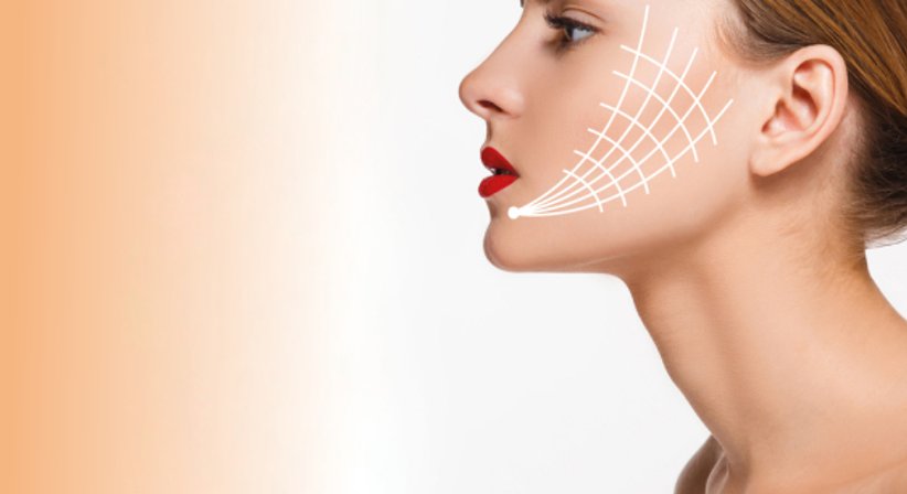 Fadenlifting - Dr. Miodrag Ognjanovic - HNO-Arzt Wien 1070