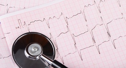 EKG (Ruhe-EKG, 24h-EKG)