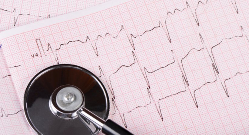 EKG (Ruhe-EKG, 24h-EKG) - Dr. Karin Schiermayer-Strecker - Internistin Wien 1230