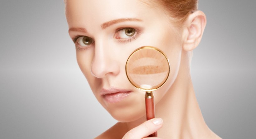 Allgemeine Dermatologie - Dr. Katja Schindler - Hautärztin Wien 1010