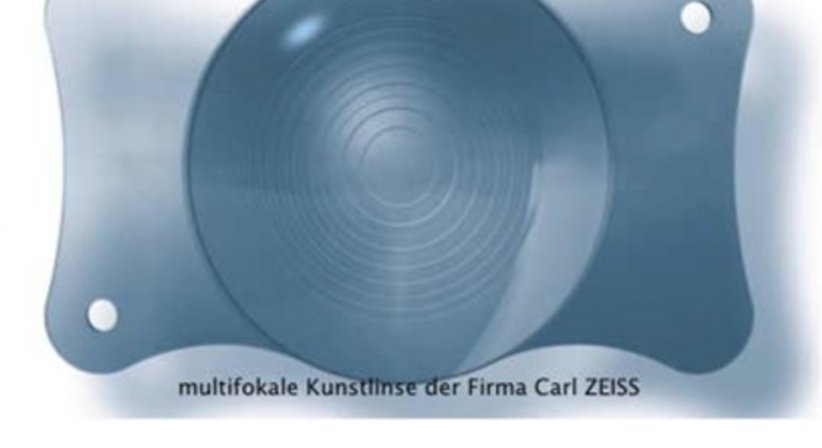 Grauer Star - Univ.-Prof. Dr. Mathias Zirm - Augenarzt Innsbruck 6020