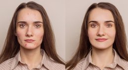 Dr. Katja Schindler - Hautärztin Wien 1080