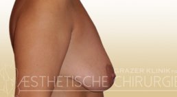 Dr. Gunther Arco - Allgemeinchirurg Graz 8055