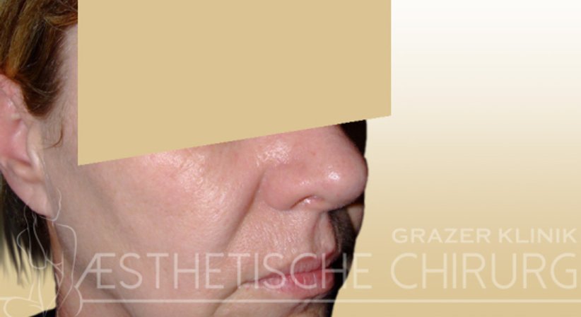 Gesicht - Dr. Gunther Arco - Allgemeinchirurg Graz 8055