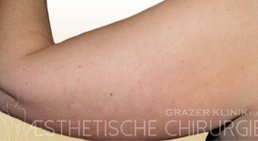 Dr. Gunther Arco - Allgemeinchirurg Graz 8055