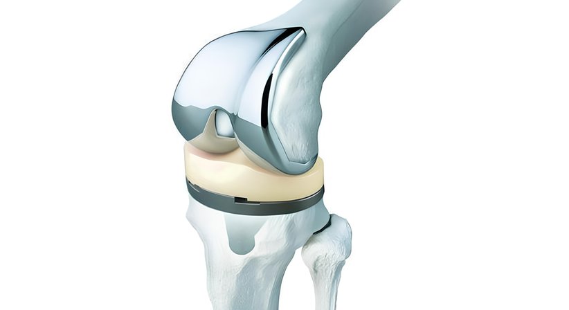 Operative Orthopädie - Dr. Pamela Jahn - Orthopädin Wien 1070