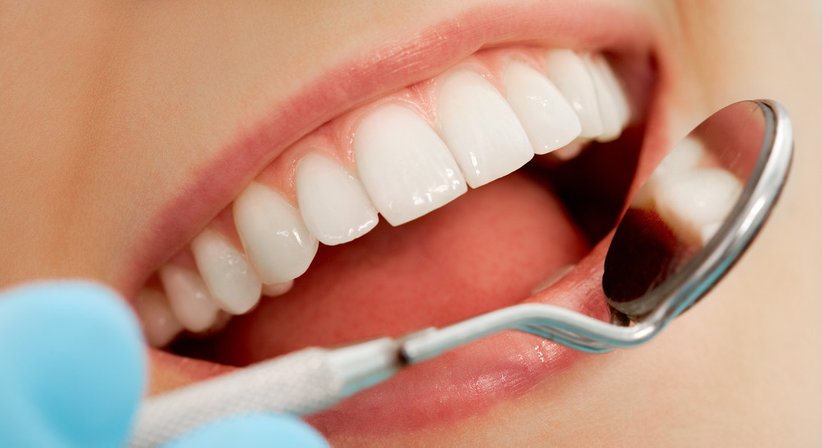 Mundhygiene - Dr. med. dent. Bertly St. Clair Osorno, MSc - Zahnärztin Wien 1150