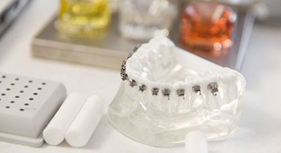 Zahnspange (festsitzend, unsichtbar)