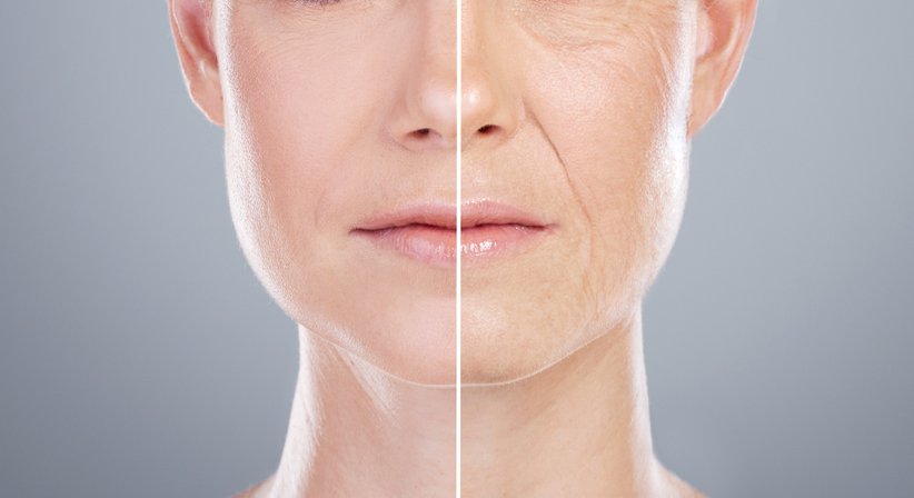 Faltenbehandlungen - Dr. Shawqi Arafat - Plastischer Chirurg Wien 1010