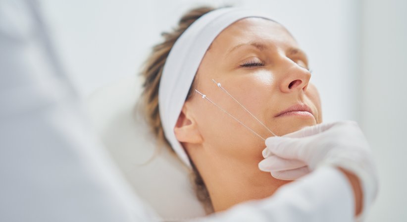 Fadenlifting  - Dr. Shawqi Arafat - Plastischer Chirurg Wien 1010