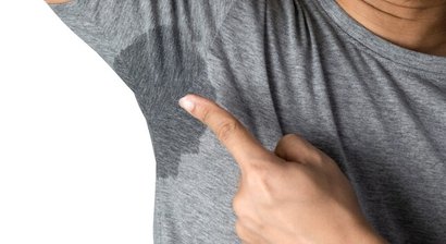 Übermäßiges Schwitzen: MiraDry-Behandlung