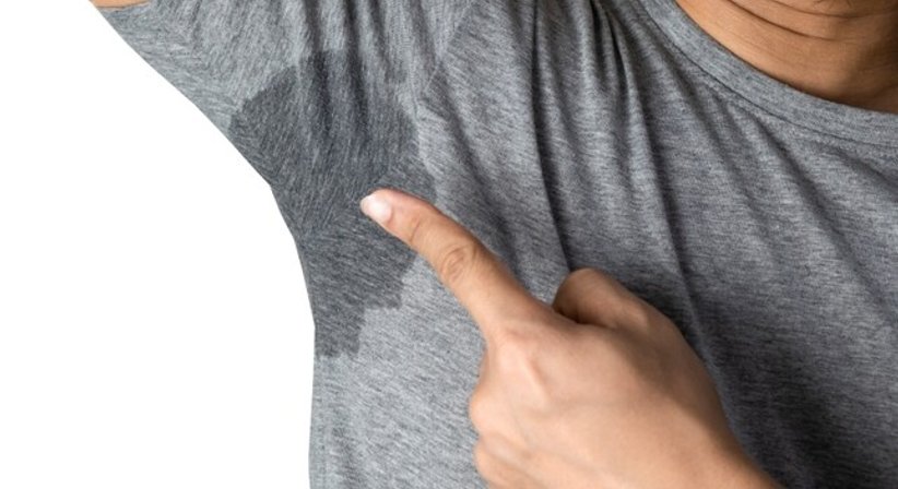 Übermäßiges Schwitzen: MiraDry-Behandlung - Dr. Shawqi Arafat - Plastischer Chirurg Wien 1010