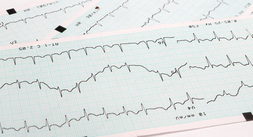 Abklärung von Herz-Kreislauf-Erkrankungen - Dr. med. univ. Fabian Waechter, MSc MBA - Praktischer Arzt Salzburg 5020