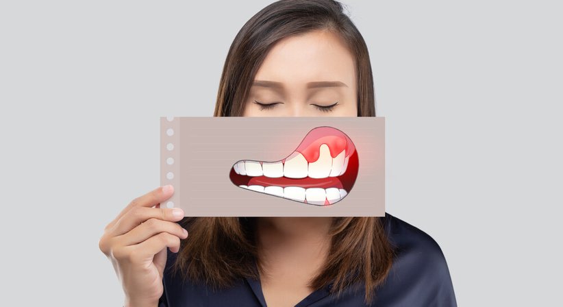 Parodonditis-Behandlung - Dr. med. dent. Kata Korsos, M.Sc. - Zahnärztin Schärding 4780