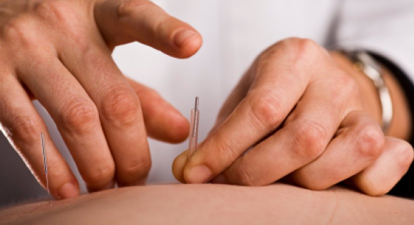 Akupunktur - Priv. Doz. Dr. Nicolas Aigner - Orthopäde Wien 1210