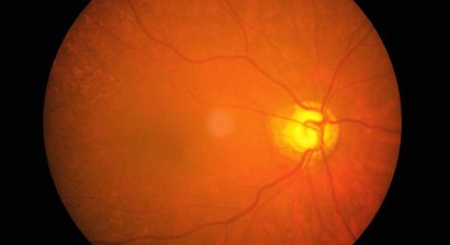Netzhautdiagnostik