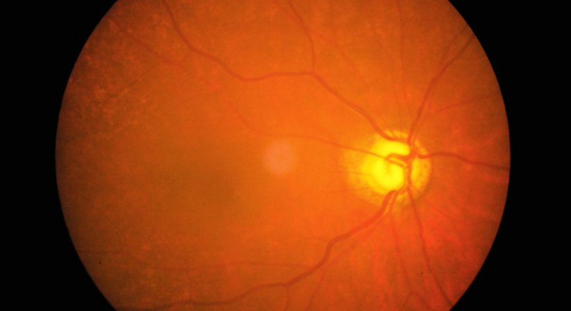 Netzhautdiagnostik - Dr. Jamal Atamniy - Augenarzt Wien 1180