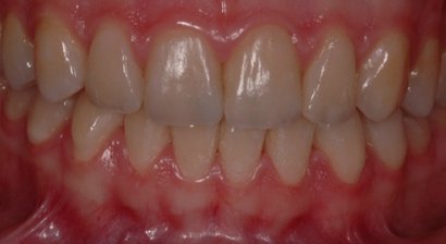 Ästhetische Zahnheilkunde