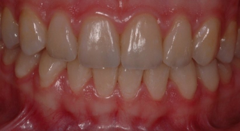 Ästhetische Zahnheilkunde - Dr. Gerwin V. Arnetzl - Zahnarzt Graz 8041