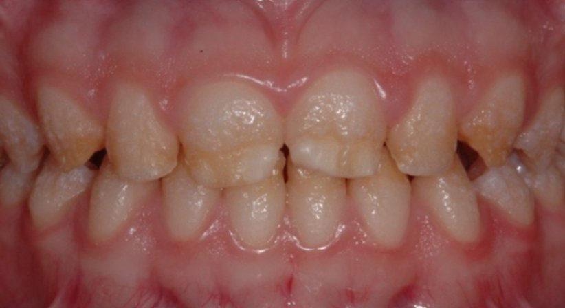 Ästhetische Zahnheilkunde - Dr. Gerwin V. Arnetzl - Zahnarzt Graz 8041