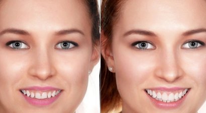 Digitales Smile Design