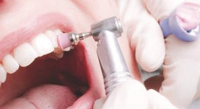 Professionelle Mundhygiene