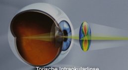 Univ. Prof. Dr. Andreas Kruger - Augenarzt Wien 1090