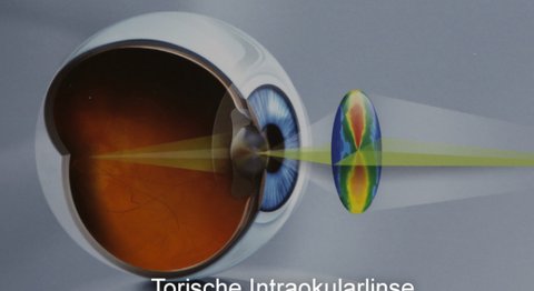 Univ. Prof. Dr. Andreas Kruger - Augenarzt Wien 1090
