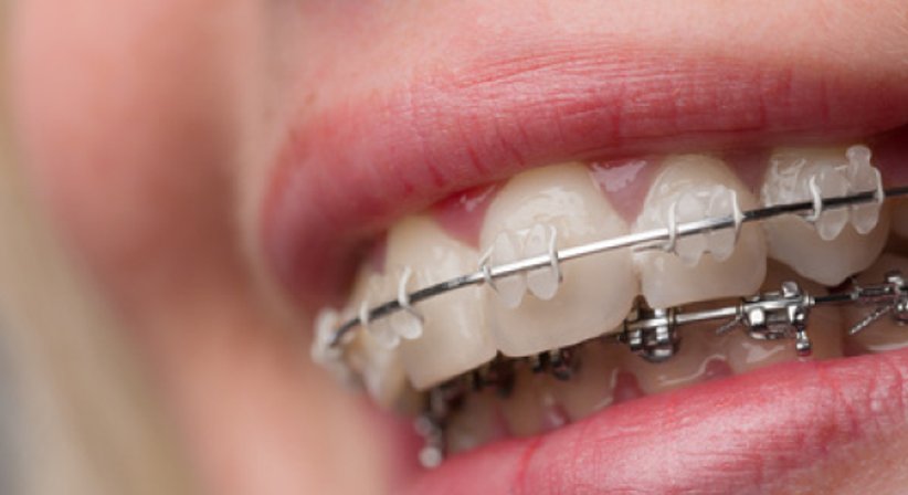 KIEFERORTHOPÄDIE - DDr. Karl Jungwirth - Zahnarzt Wien 1210