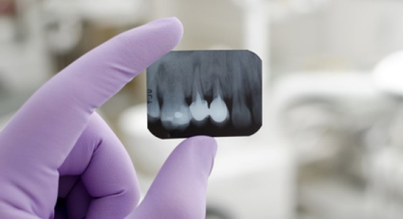 WURZELBEHANDLUNGEN - DDr. Karl Jungwirth - Zahnarzt Wien 1210