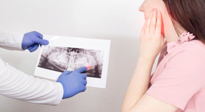 Weisheitszahnentfernung