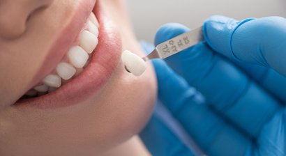 Kronen- und Brückenversorgung