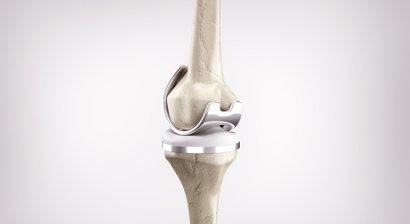 Implantation von Knie- und Hüftprothesen