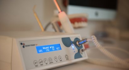 Zähne bleichen (Bleaching)