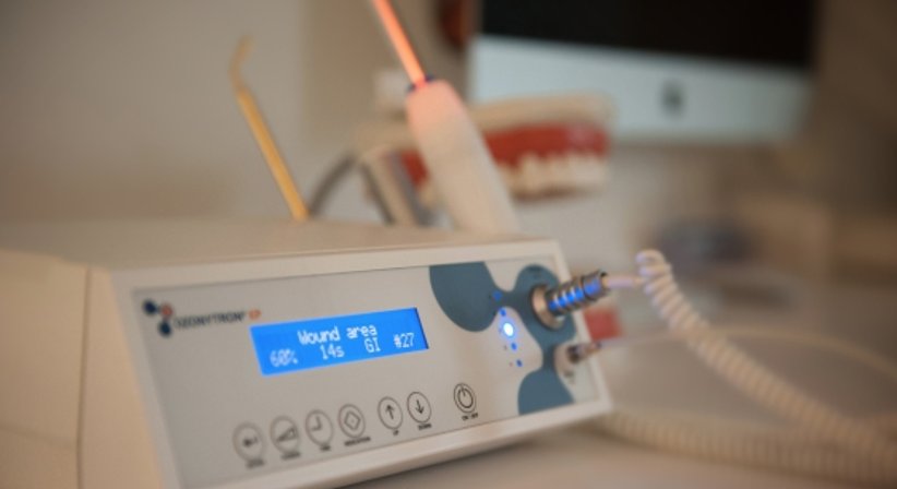 Zähne bleichen (Bleaching) - Dr. med.dent. Martin Schiffl - Zahnarzt Salzburg 5020