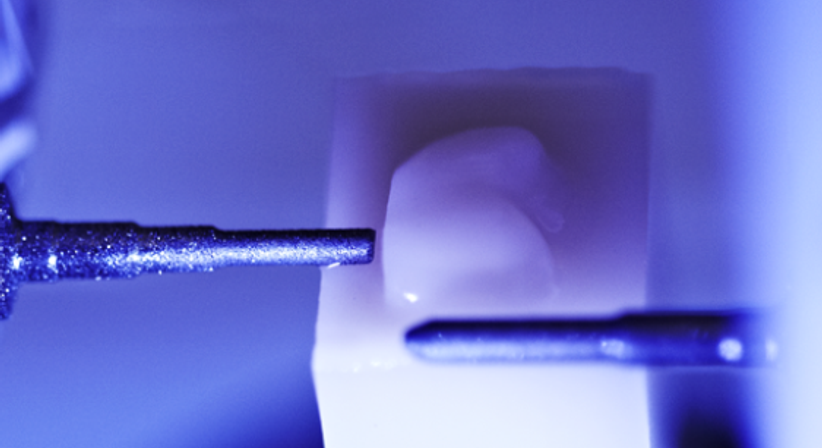 Zahnkrone & Inlay - Dr. med.dent. Martin Schiffl - Zahnarzt Salzburg 5020