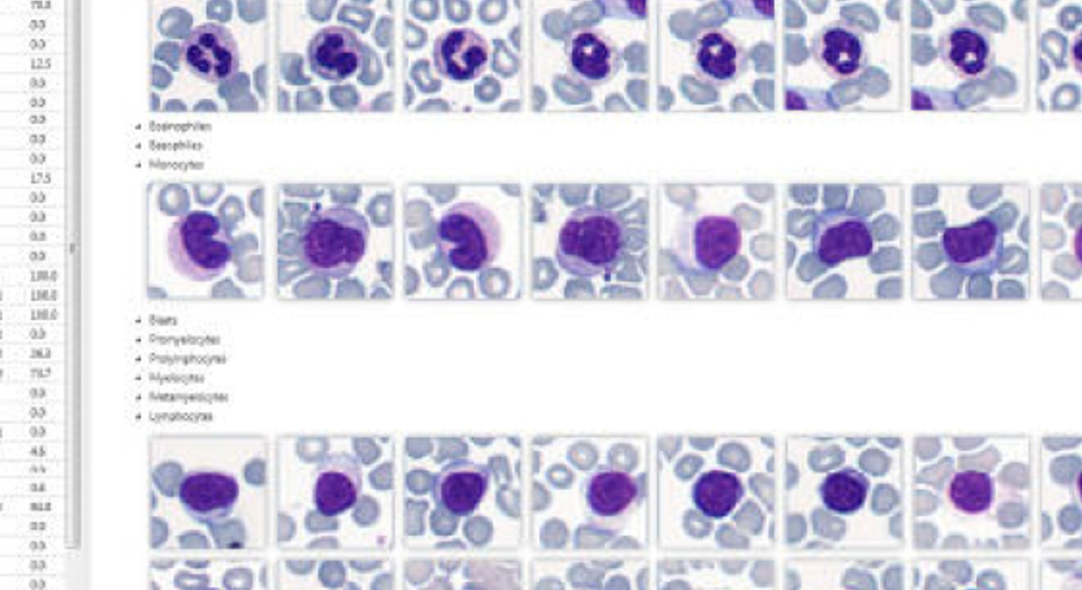 OA Dr. Wolfgang Fiebiger Behandlung Hämatologischer Grunderkrankungen